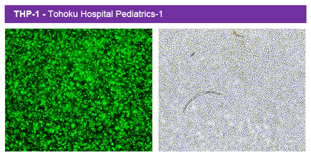 1767065389529777.jpg Macro300-2.jpg